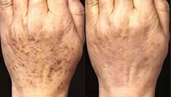 讓你愛上椰子油!整理了60種椰子油的妙用,拿走不謝!
