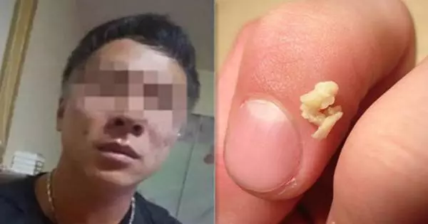 我從小就有口臭的困擾,都聞到「怪怪的味道」,去看醫生後……真相大白了!