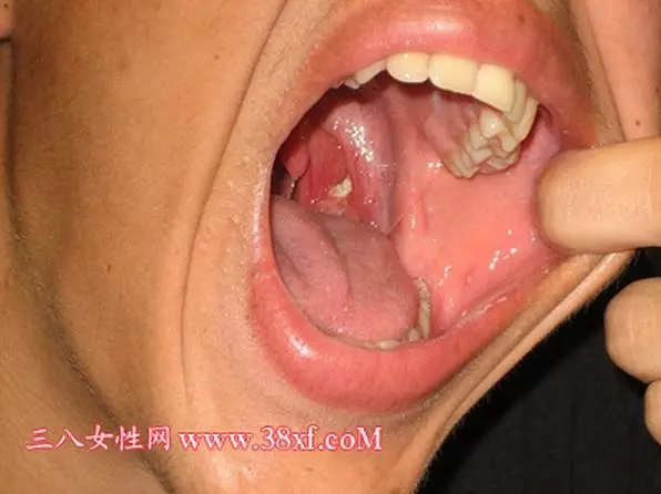 我從小就有口臭的困擾,都聞到「怪怪的味道」,去看醫生後……真相大白了!