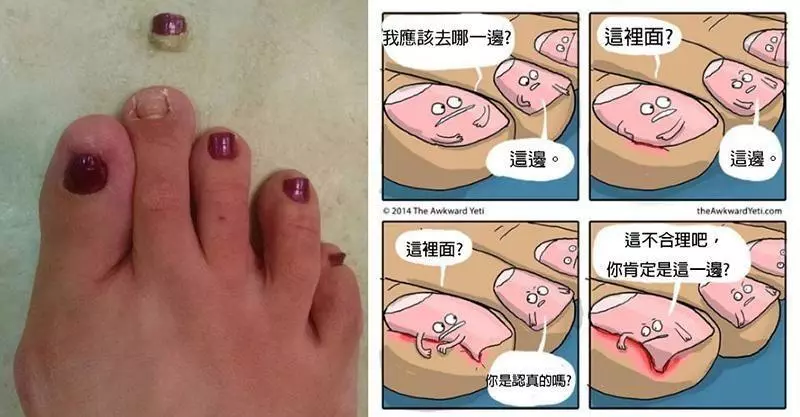 17個會讓人覺得超噁爛的「腳指甲知識」 人類的腳指甲其實是爪子