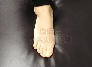 低頭摸腳,讓你一身輕鬆!很多病在腳上都有開關!