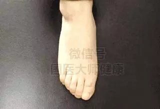 低頭摸腳,讓你一身輕鬆!很多病在腳上都有開關!