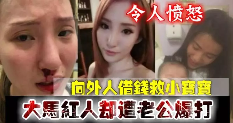 令人憤怒~向外人借錢救小寶寶,大馬紅人卻遭老公爆打