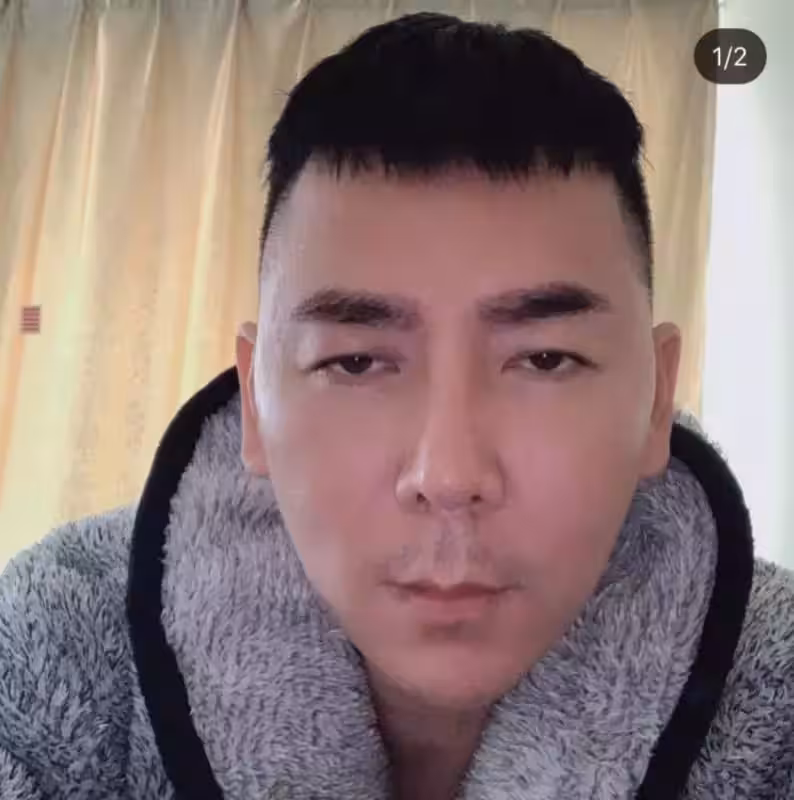 整容失敗損失重!李榮達:「我不在乎錢!整容為了好看現在沒法忍!」