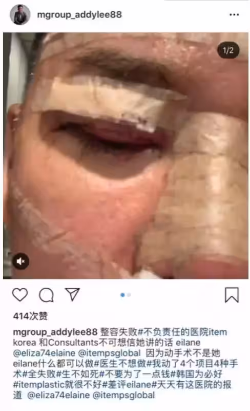 整容失敗損失重!李榮達:「我不在乎錢!整容為了好看現在沒法忍!」