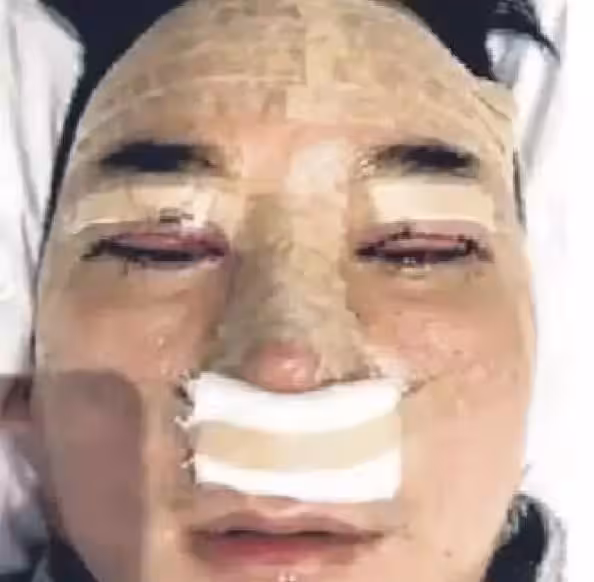 整容失敗損失重!李榮達:「我不在乎錢!整容為了好看現在沒法忍!」