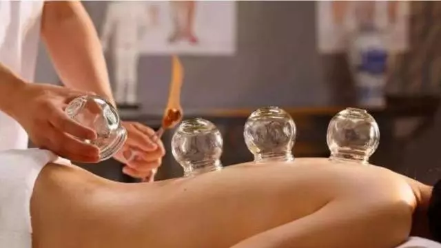 拔罐真的可以排毒嗎?告訴你拔出的顏色深淺代表什麼意義