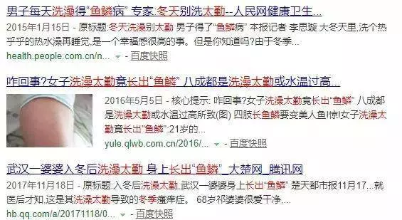 女孩天天洗澡竟長出「魚鱗」,醫生提醒:冬天洗澡別做這6件事