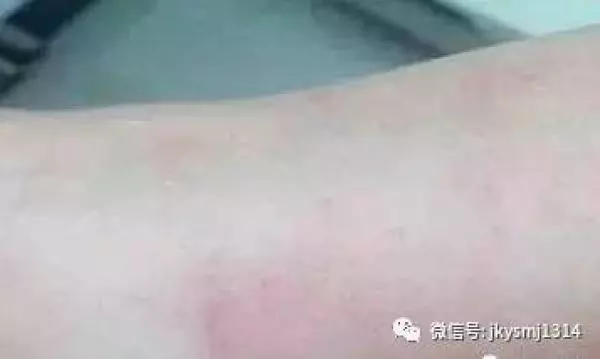 再不注意這6個信號!你的血管就要堵了!