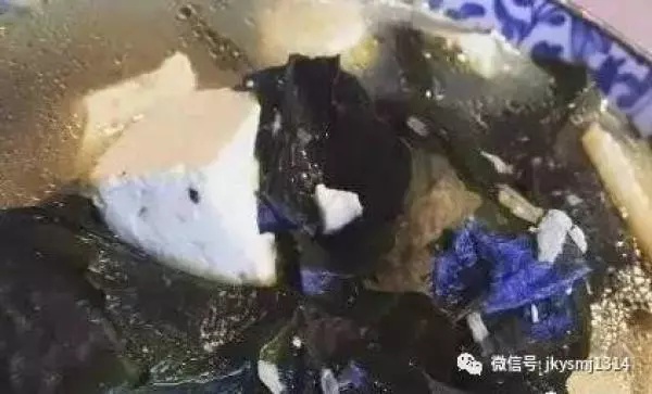再不注意這6個信號!你的血管就要堵了!