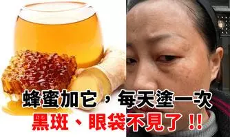 再不注意這6個信號!你的血管就要堵了!