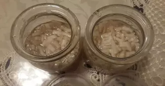 再不注意這6個信號!你的血管就要堵了!