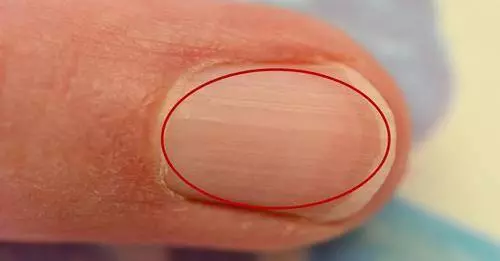 你的指甲上有一道道直線嗎?性格命運大不同,據說很準