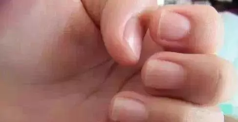你的指甲上有一道道直線嗎?性格命運大不同,據說很準