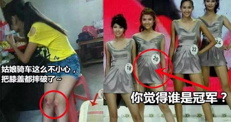 超搞笑的25張內涵圖,據說男生才看得懂。姑娘騎車這麼不小心,把膝蓋都摔破了...