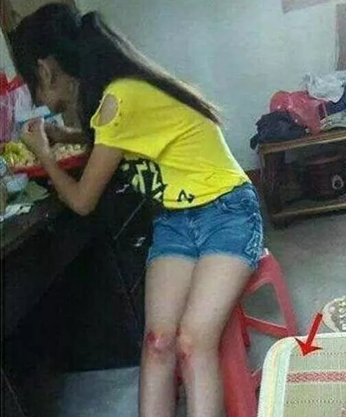 超搞笑的25張內涵圖,據說男生才看得懂。姑娘騎車這麼不小心,把膝蓋都摔破了...