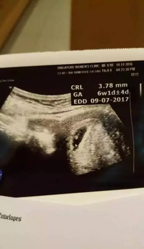 新加坡又現渣男,做了一堆沒品的事不說,分手後還把前女友形容成「用過的玩具」!!真是可惜了這麼美的女朋友!