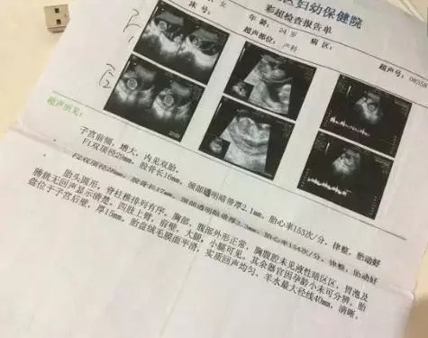 家婆五十多歲懷孕了,老公堅持讓婆婆生,瞥見產檢單,俺如遭雷擊