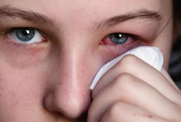 眼睛疲勞、視力減退是因為「視紫質」不足,多吃這7種水果就可以「把營養吃回來」!!