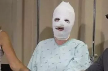 女友臉上毀容,男子堅決娶回家,被鄉親們嘲笑,掀開蓋布全場蒙住