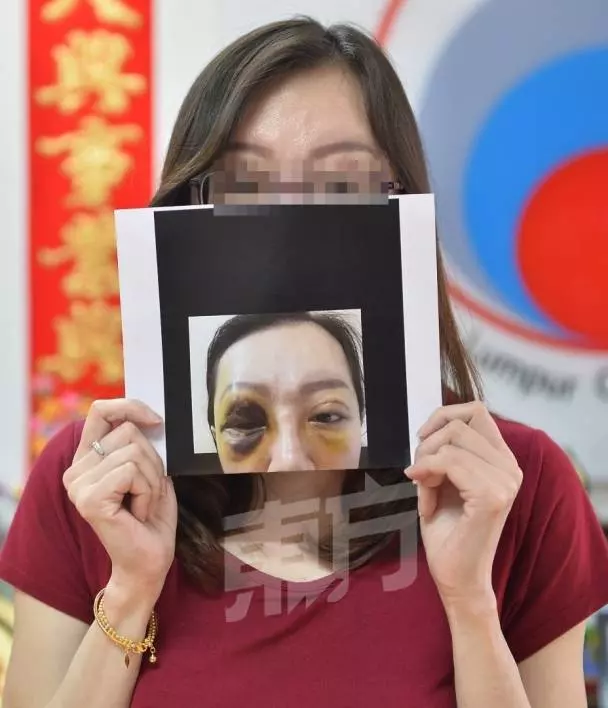 【大馬籍醫生被判停牌罰款】患者手術後，終身無法形房！