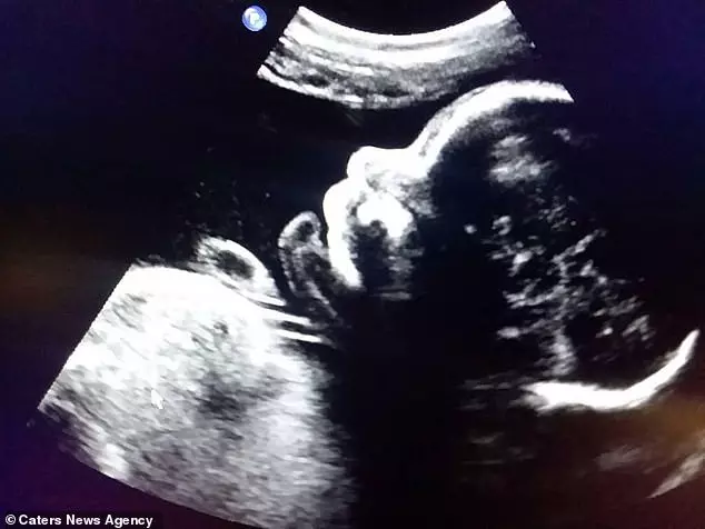 曾是女兒身!他變性成男人「某天卻意外懷孕」 挺大肚上街「被路人罵怪物」9個月後奇蹟:再痛都值得