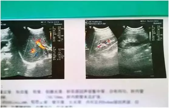 這種腫瘤70%的人都有,可能無關痛癢,也可能癌變!快看你身上有沒有