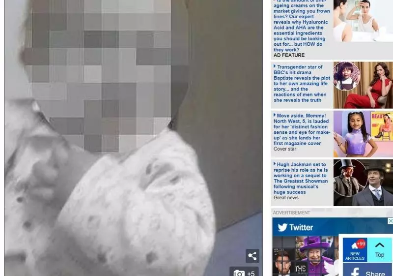 媽媽拿熱水燙傷女兒 ,拿塑膠袋包住後就和男友出門去玩,5歲哥向鄰居求救