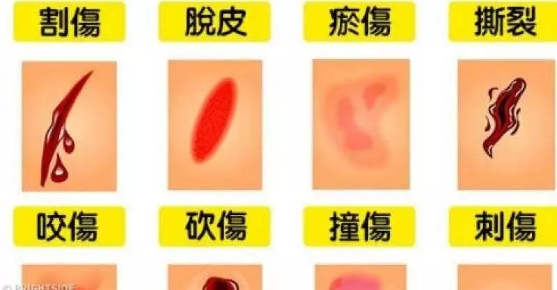 9個你以為正確,專家卻告訴你錯很大的急救行為!不要害死對方…