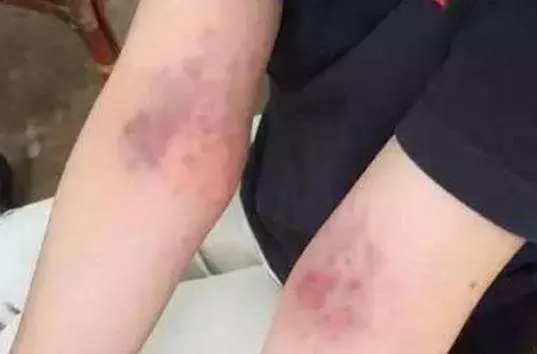 它是排毒「總開關」,每天拍這3處,排出血毒、腎毒、肝臟毒,不吃藥也能排得一乾二淨!