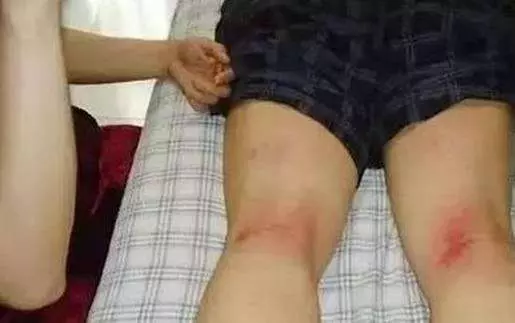它是排毒「總開關」,每天拍這3處,排出血毒、腎毒、肝臟毒,不吃藥也能排得一乾二淨!
