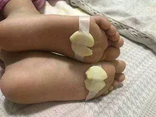 咳嗽不用吃,包在腳底,咳得再久都痊癒!