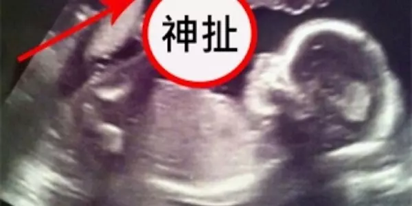 媽媽照超音波照到一半,護士開始尖叫、醫生都呆了!她肚子竟有「這些東西」!根本神蹟降臨!