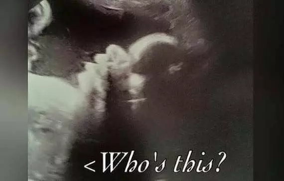 媽媽照超音波照到一半,護士開始尖叫、醫生都呆了!她肚子竟有「這些東西」!根本神蹟降臨!