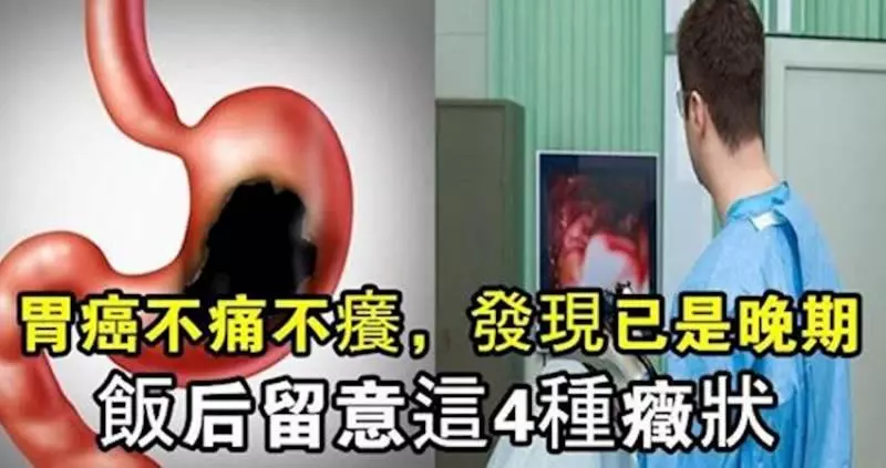 胃癌不痛不癢,發現已是晚期,飯後要留意這4種症狀,關鍵時刻能救命!