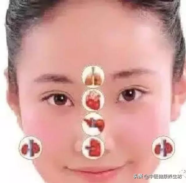 看臉識病情!面診你會嗎?收藏起來吧!