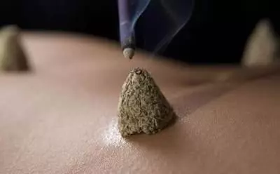 艾灸調理各種失眠!入睡難,順肝;容易醒,調脾……