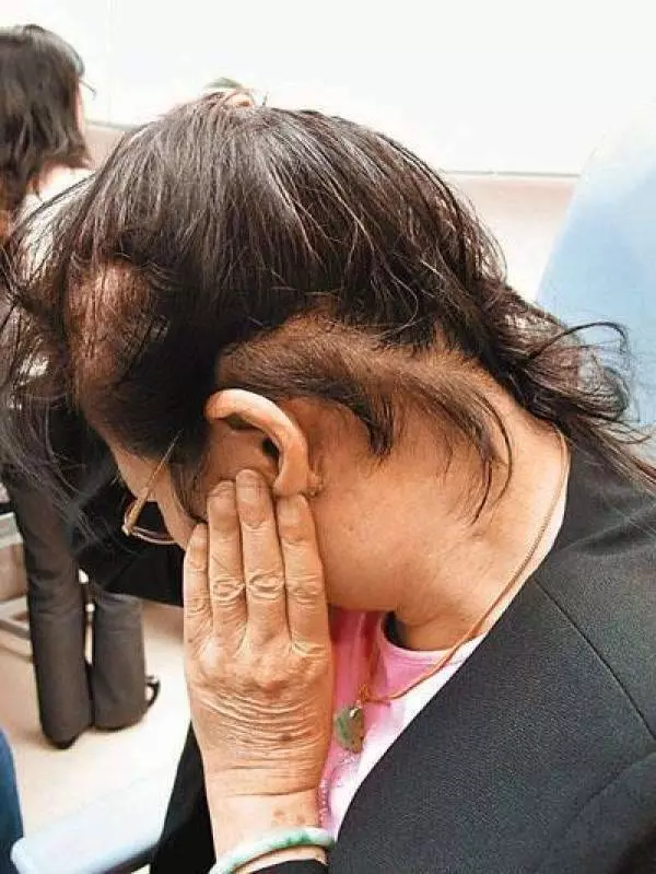 女孩每天手機不離手 耳朵長出這個東西