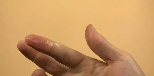 手指被膠水粘住怎麼辦?別著急,只需滴一些它,膠水立馬融化!