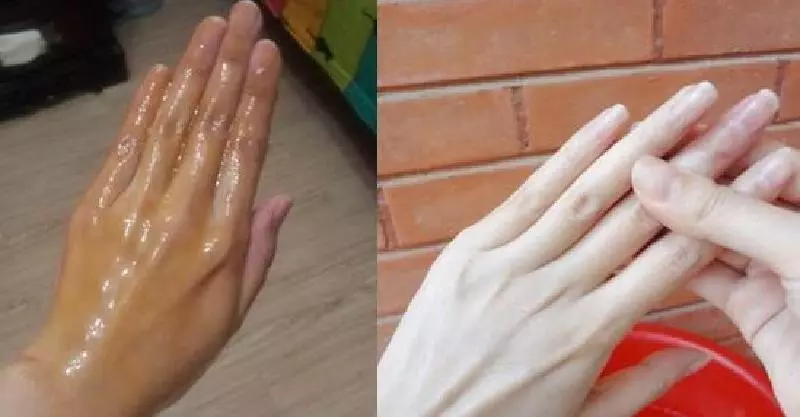 女人手曬黑不要慌,睡前去廚房抹點便宜小物,三天變回白嫩小手!