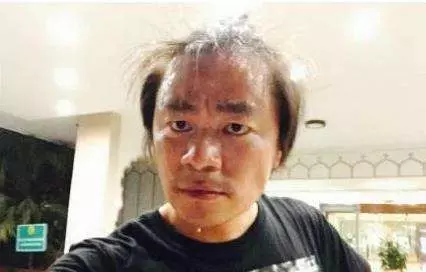 吃頓飯像洗了個澡一樣全身濕透?不是排毒!可能是你身體的這個部位出現了問題!