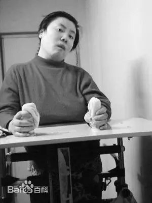 北京清華才女遭忌 疑室友三次下毒 頭髮掉光智商只剩7歲