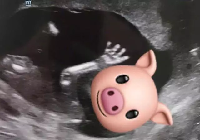 胡杏兒宣布懷二胎後首曬孕肚照,小腹微微隆起,氣質優雅氣色好