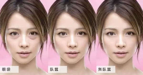 「眼袋」才不是臥蠶!簡單幾招讓你輕鬆跟眼袋說掰掰!