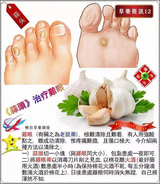 30種草藥簡訊 很全面 收藏就是賺到了