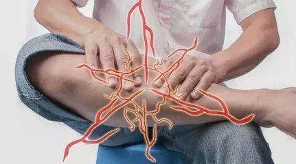 睡到半夜突然小腿抽筋?用這4種急救方法,有效通經止痛