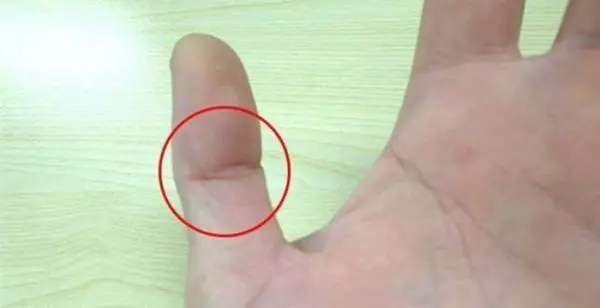 左手拇指上有佛眼的女人,不簡單你有嗎?