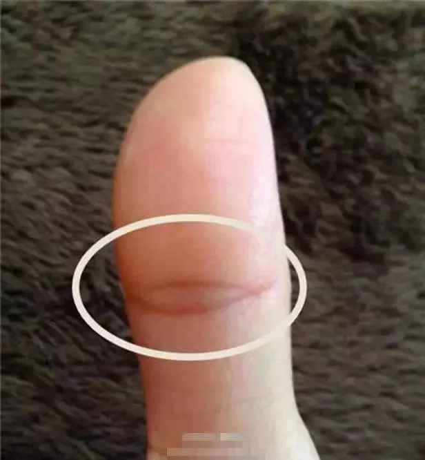 左手拇指上有佛眼的女人,不簡單你有嗎?