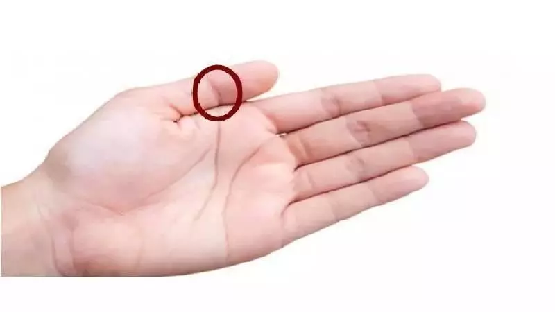 左手拇指上有佛眼的女人,不簡單你有嗎?