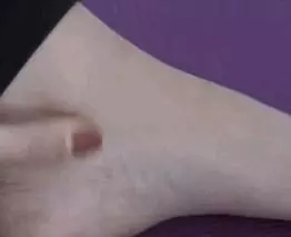 上火熱氣,不怕,人體自帶3個降火的穴位,經常按摩,能消炎下火